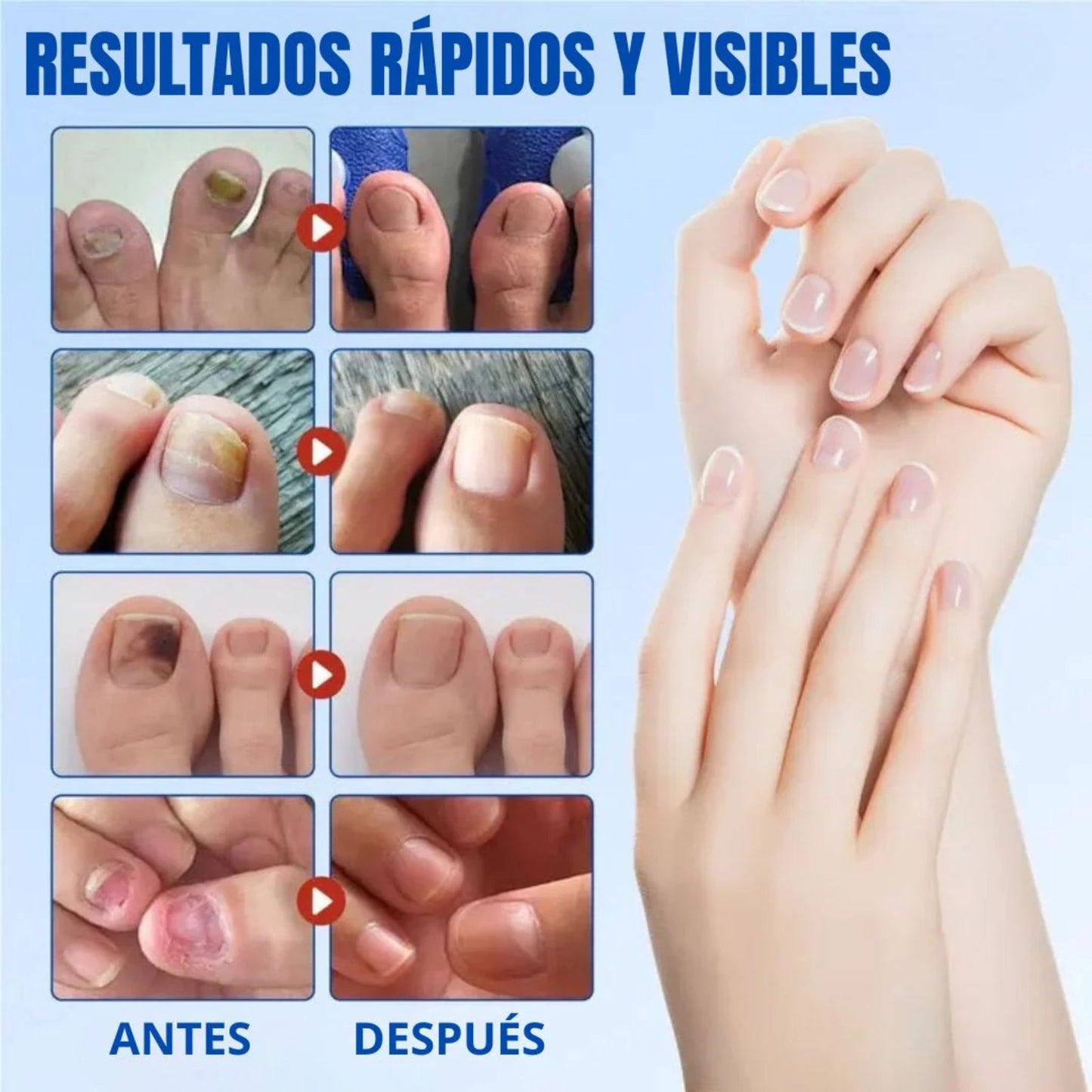 FungiStop Pro - Reduce hongos y fortalece la uña ⭐⭐⭐⭐⭐