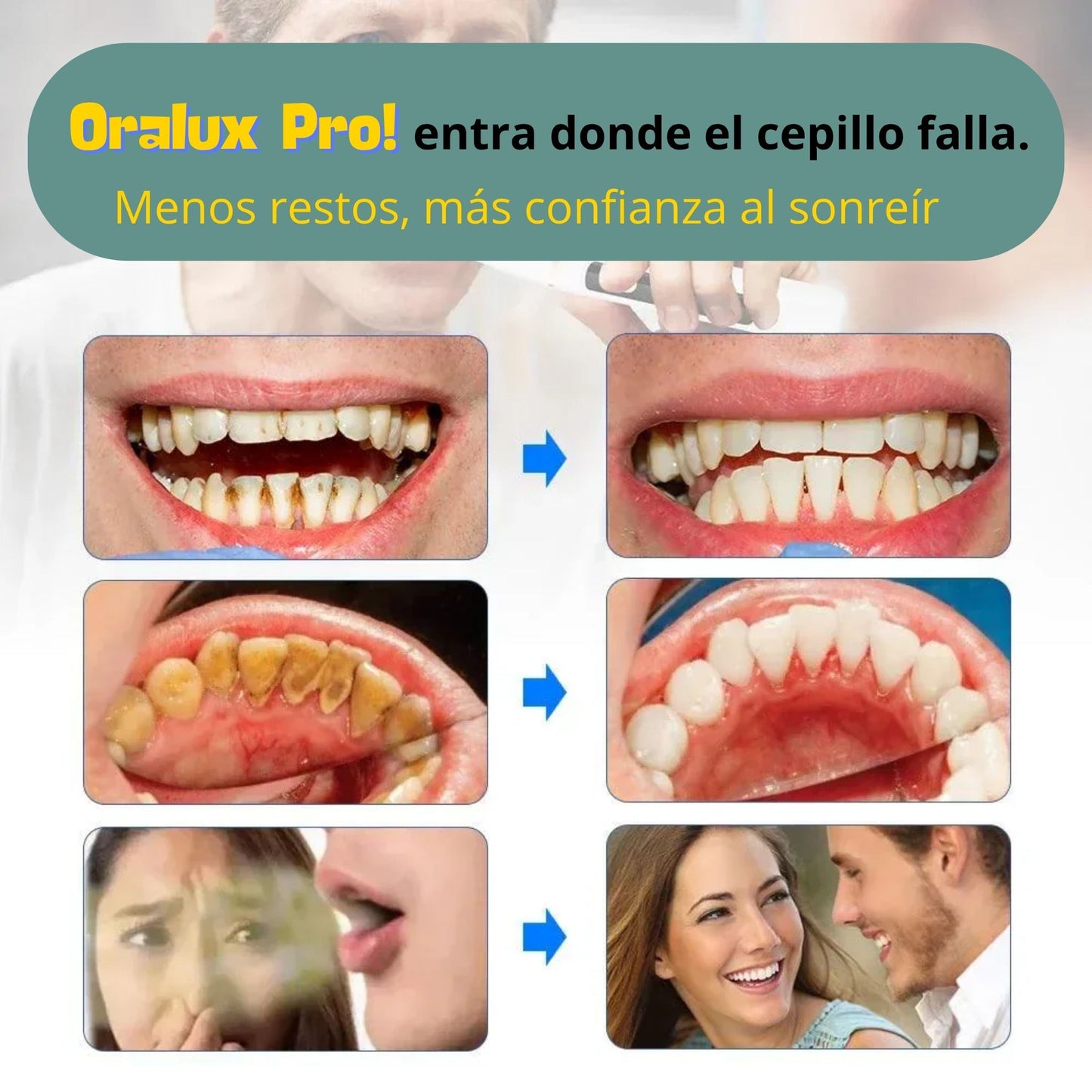 Oralux Pro - Limpieza profunda interdental ⭐⭐⭐⭐⭐